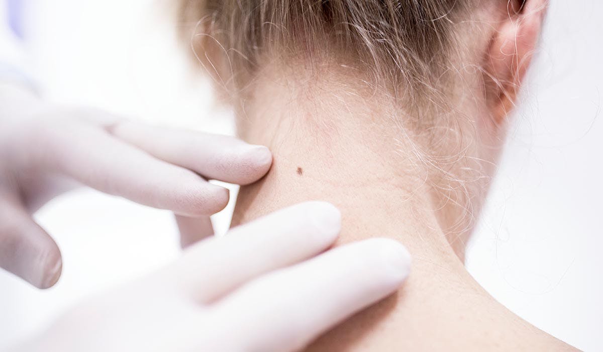 A guide to mole changes and checks